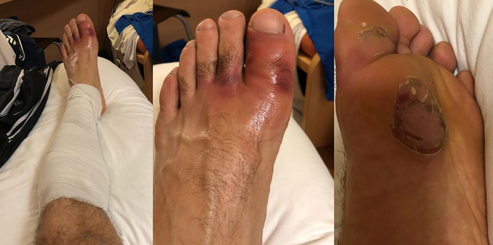 Рафаэль Агаев травма на open-de-Paris 2018